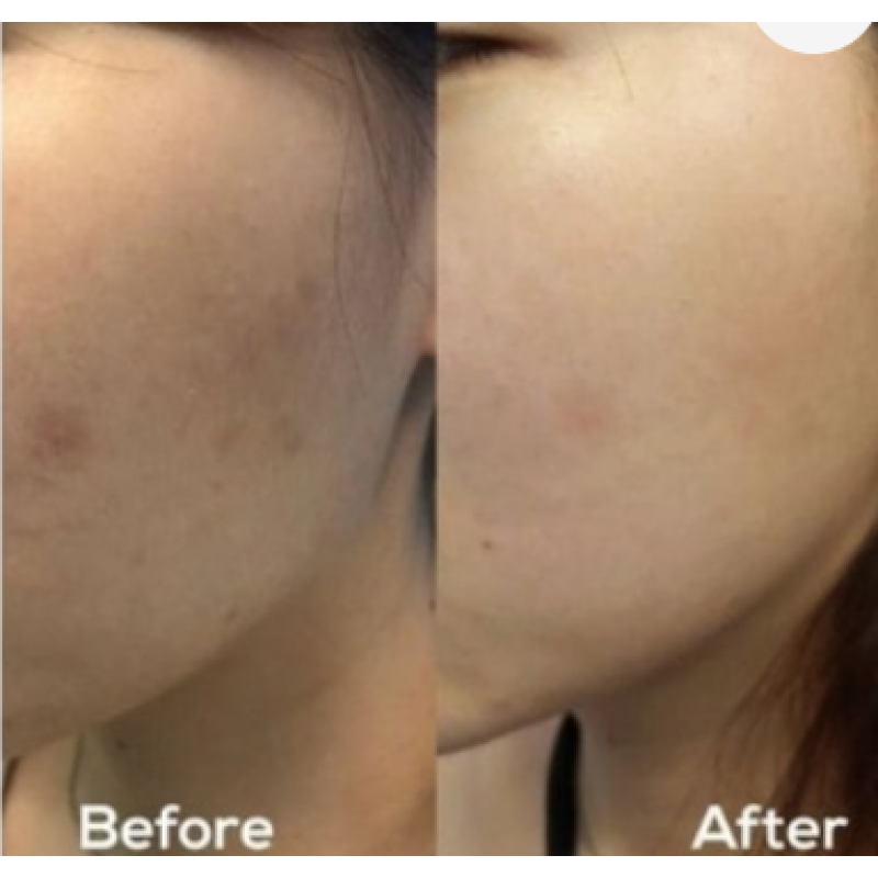 Осветляющая сыворотка для пигментации и сыпи AXIS-Y Dark Spot Correcting Glow Serum, 50 мл