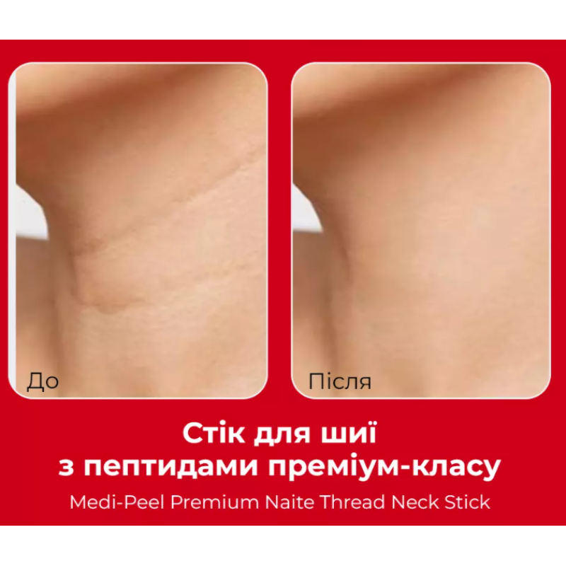 Стик для шеи с пептидами премиум-класса MEDIPEEL Premium Naite 1000 Shot Neck Stick 2.0, 20 гр
