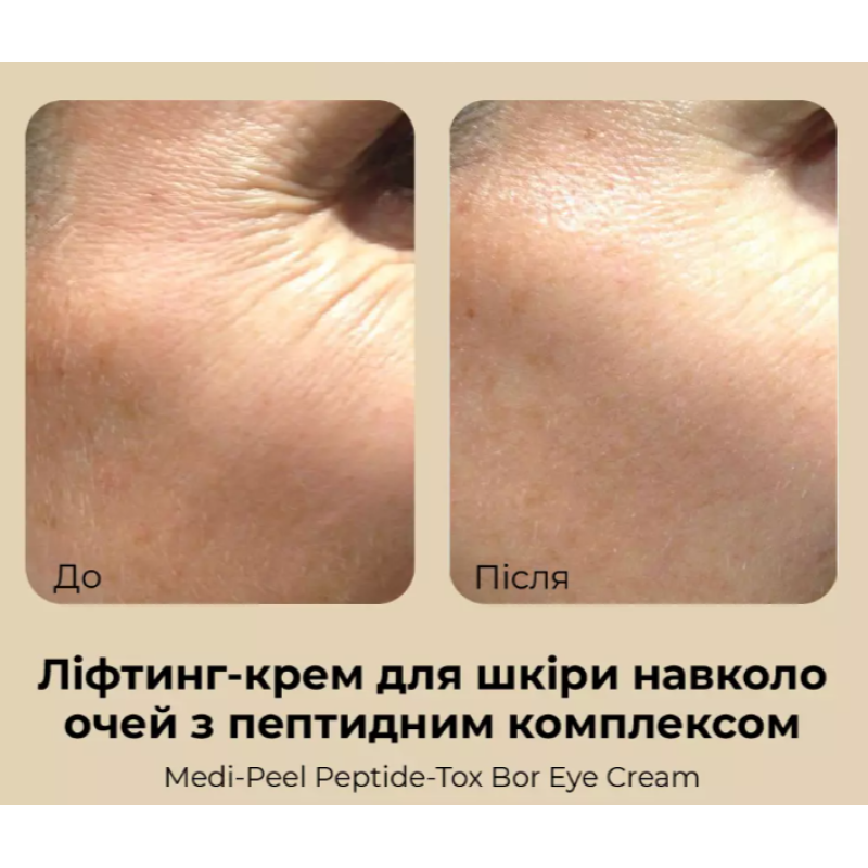 Лифтинг крем для кожи вокруг глаз с пептидным комплексом MEDIPEEL Peptide-Tox Bor Eye Cream, 40 мл